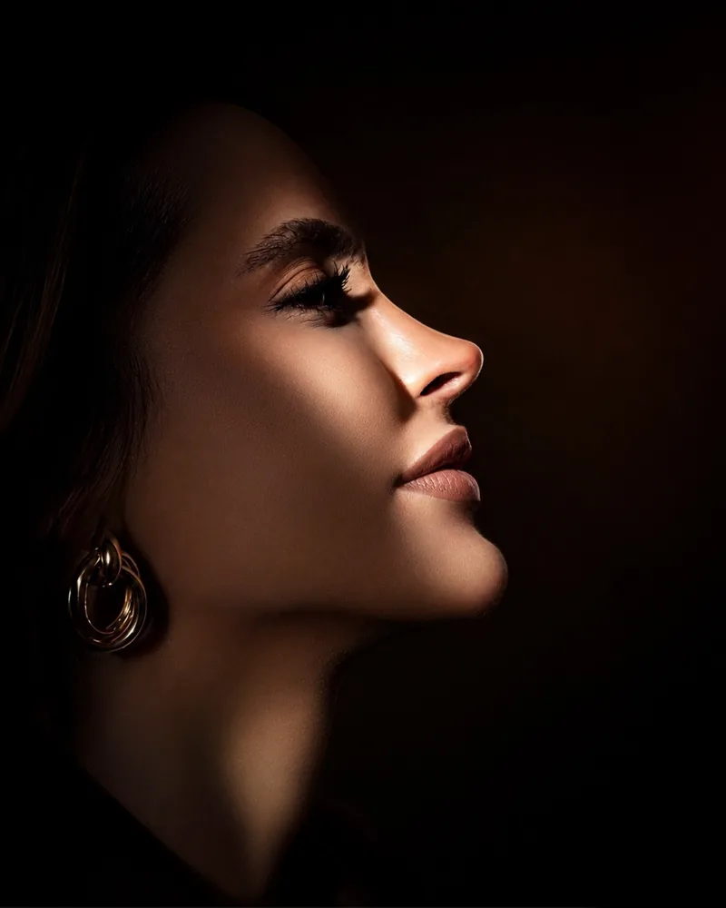 Rinoplastia